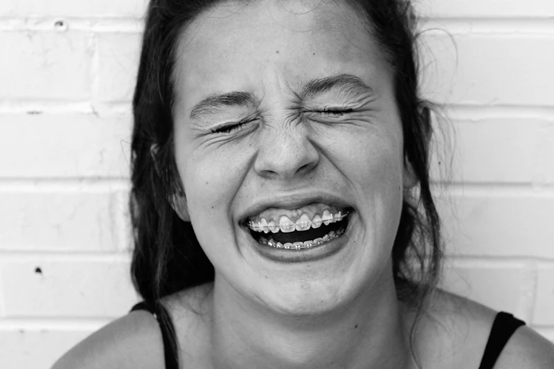 Black-and-white photo of a young woman laughing, wearing metal braces