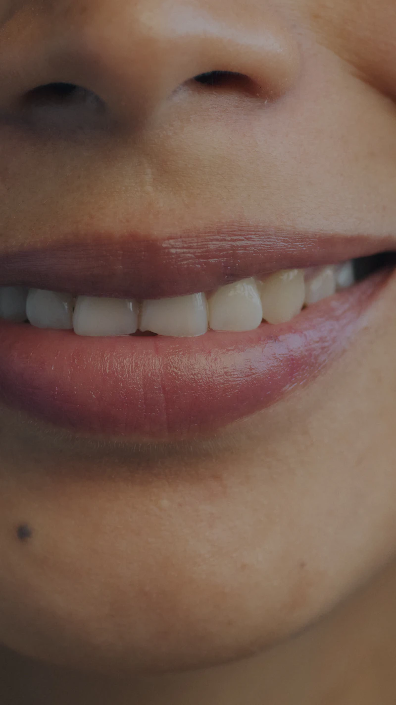 Close-up of an even, bright smile